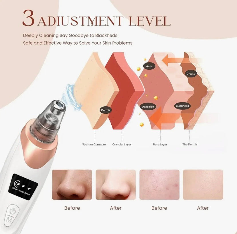 5 in 1 Electric Blackhead Acne Oil Remover Vacuum Suction Face Pore Cleaner Machine